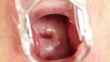 Redhead grandma Zita internal slit cervix shots