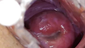 Speculum in a taut madam medic pussy